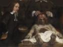 Rembrandt van Rhijn, Die Anatomie des Dr. Jan Deijman